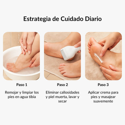 Removedor Eléctrico de Callos